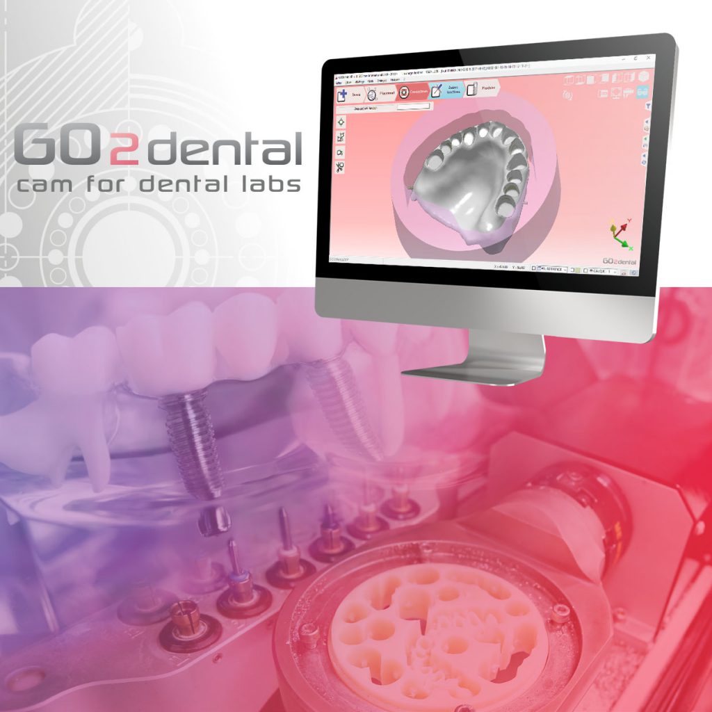 GO2dental by GO2cam, CAM software for dental labs